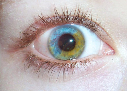 интересный глаз: зелено-голубой
